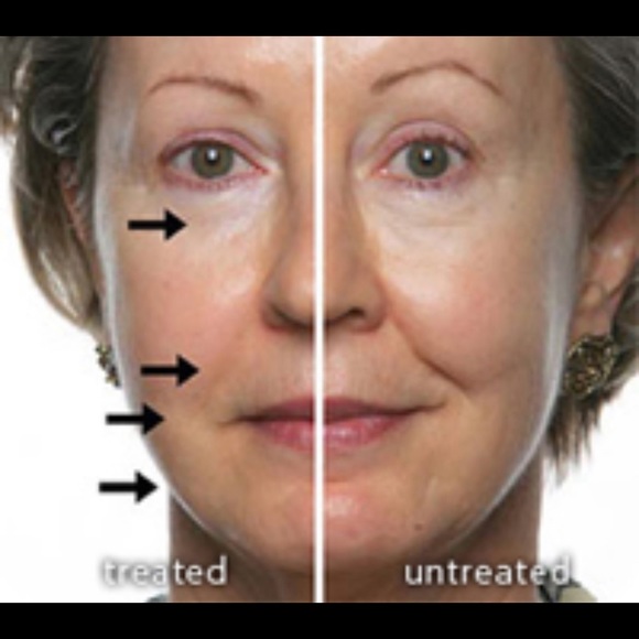 [NIB] Nuskin facial spa + conductive gel - Picture 6 of 9